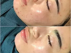 Michelle Omotesando – Specialized Salon for Korean Herbal Yomogi Steam Therapy with Yellow Soil 5